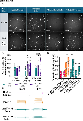Astrocyte dysfunction distinguishes monozygotic twin C9orf72 expansion carriers discordant for amyotrophic lateral sclerosis.