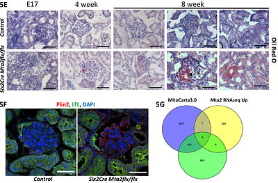 Deletion of NuRD component Mta2 in nephron progenitor cells causes developmentally programmed FSGS