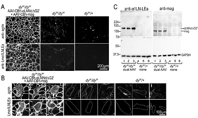 Dual AAV amelioration of Lama2-null muscular dystrophy and neuropathy