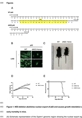 Continuous Nuclear Export of p62/SQSTM1 Is Essential for Kidney Homeostasis