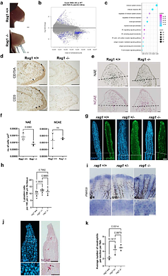 Adaptive immunity is dispensable for appendage regeneration in highly regenerative vertebrates