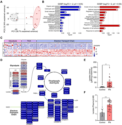 Lactate-dependent metabolic rewiring is associated with CD163+ macrophage polarization in human pyelonephritis