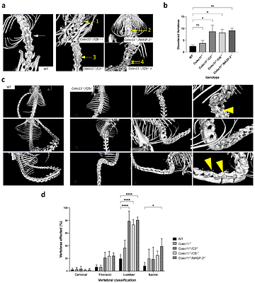 Collectin-11 regulates osteoclastogenesis and bone maintenance via a complement-dependent mechanism.