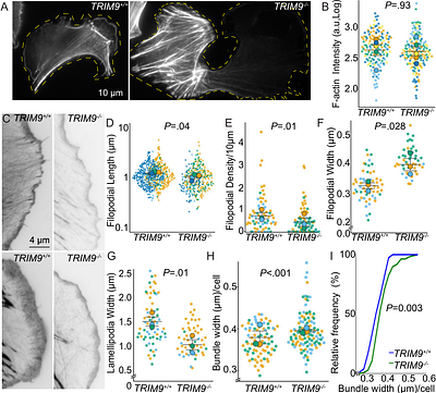 TRIM9 switches the morphological phenotype of melanoma cells
