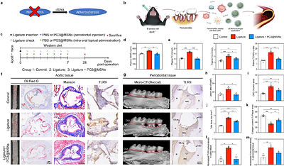 Therapeutic targeting inflammation linking periodontitis and atherosclerotic comorbidities using cell-free DNA-capturing nanomaterials
