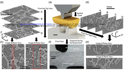 Quantifying Brittle Crack Opening in Human Trabecular Bone Using Synchrotron XCT-DVC
