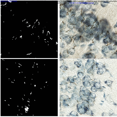 A Novel Framework for Quantitative Analysis of Neuronal Primary Cilia in Brain Tissue