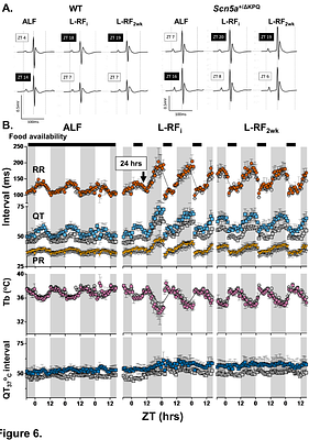 Feeding Behavior Modifies Daily Rhythms in Autonomic Signaling and Core Body Temperature to Shape 24-hour Rhythms in Cardiac Electrophysiology