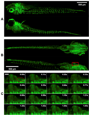 Mesoscopic SCAPE Microscope with a Rescanned, Super-oblique Illumination Plane