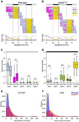 Usherin in the pineal gland: altered sleep in zebrafish models of Usher syndrome type 2a