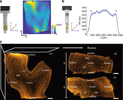 aDISCO: A Broadly Applicable Method for 3D Microscopy of Archival Paraffin-Embedded Human Tissues