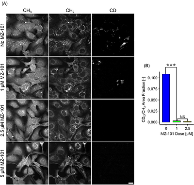 QUANTIFYING GLYCOGEN AND LIPID DROPLET SYNTHESIS IN OVARIAN AND CERVICAL CANCER CELLS USING DEUTERATED RAMAN PROBES WITH STIMULATED RAMAN SCATTERING MICROSCOPY