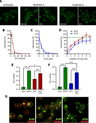 Globoside is an essential intracellular factor required for parvovirus B19 endosomal escape in erythroid progenitor cells