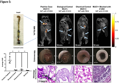 Targeted Molecular MRI of Colorectal Cancer by Antibody Functionalized Hyperpolarized Silicon Particles