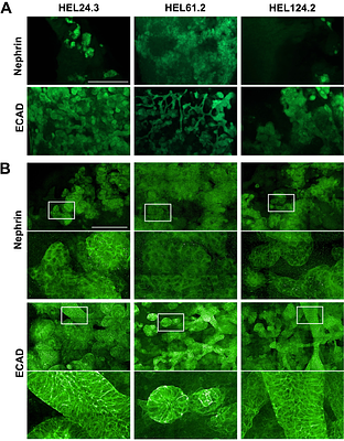 Parsing glomerular and tubular structure variability in high-throughput kidney organoid culture