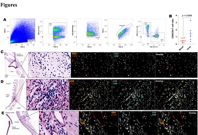 Tissue resident memory T cells populate the human uveal tract