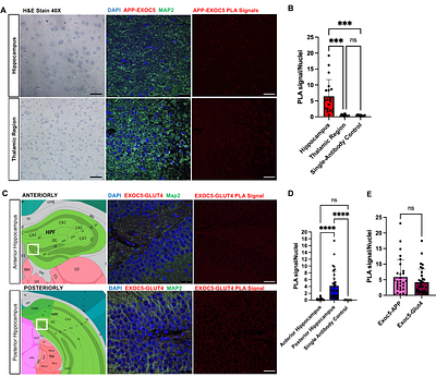 The exocyst is an insulin-sensitive regulator of amyloid precursor protein trafficking and amyloid-beta generation in neurons