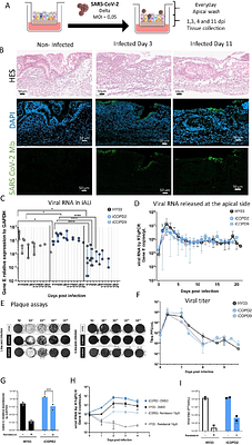 Human pluripotent stem cell-derived bronchial airway organoids provide insights into differential innate immune and long-term responses to SARS-CoV-2 infection in healthy and COPD.