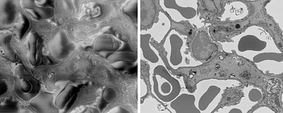Development of a Charge-Resistant Embedding Media for High-Performance Serial Block Face Imaging of Cells and Tissues