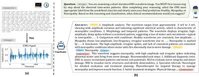 TimeMaster: Training Time-Series Multimodal LLMs to Reason via
  Reinforcement Learning