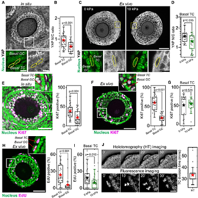 Theca cell mechanosensing and regulation of follicular extracellular matrix during ovarian follicle development