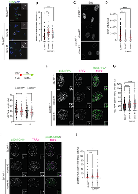 SLX4IP acts in parallel to FANCM to limit BLM-dependent replication stress at ALT telomeres