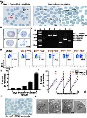 Continuous In Vitro Propagation of the Human Pathogen Babesia microti in Human Erythrocytes
