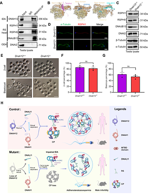 Deficiency in a special dynein DNAH12 causes male infertility by impairing DNAH1 and DNALI1 recruitment in humans and mice