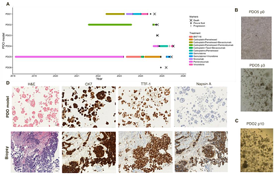 Patient-derived organoids from malignant pleural effusion to explore for alternative therapies in thoracic tumors