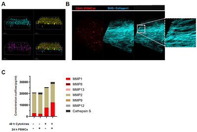 Induction of cervical dysfunction associated with preterm birth by IL-1 and dysbiotic microbiome revealed in human endocervix chips