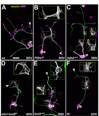 Assessing impacts of mitochondrial dysfunction on axonal microtubule bundles as potential mechanism in neurodegeneration