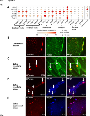The Critical Role of Pdyn-Lineage Enteric Neurons in Colonic Motility and Visceral Interoception