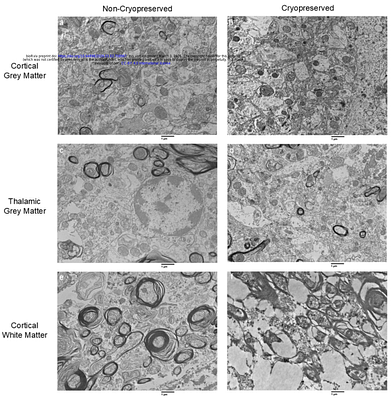 Aldehyde-based cryopreservation of whole brains