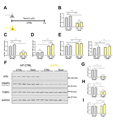 The ataxia-telangiectasia disease protein ATM controls vesicular protein secretion via CHGA and microtubule dynamics via CRMP5