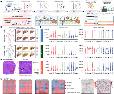 Spatial Glyco-Codes Define Human Liver Pathology and Progression