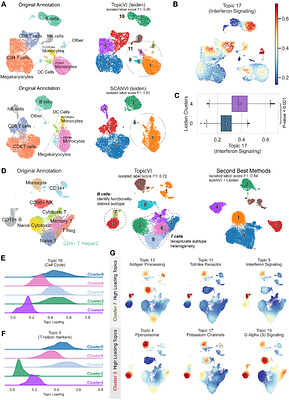 TopicVI: A Knowledge-guided deep interpretable model for resolving context-specific gene programs