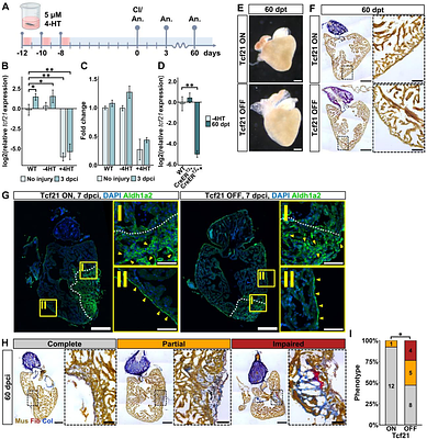 Epicardial Tcf21 facilitates cardiomyocyte dedifferentiation and heart regeneration in zebrafish