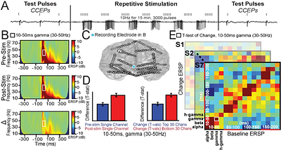 Direct cortical stimulation induces short-term plasticity of neural oscillations in humans