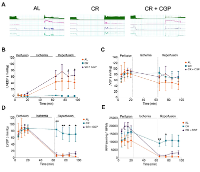 Caloric Restriction Promotes Ischemia/Reperfusion Cardioprotection Through Increased Mitochondrial Na+/Ca2+ Exchange