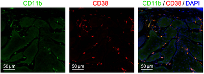 NAD boosting mediated by CD38 inhibition drives reversal of a pathological vicious cycle of intracrine activity and inflammation in eyelid meibomian gland dysfunction
