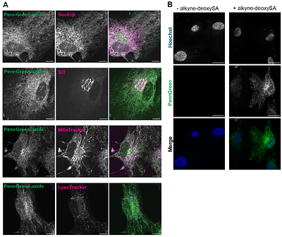 1-Deoxysphingolipids dysregulate membrane properties and cargo trafficking in the early secretory pathway