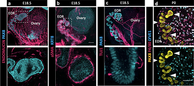 Rediscovering the Rete Ovarii: a secreting auxiliary structure to the ovary