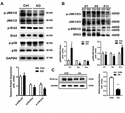 Protein Phosphatase 2A Orchestrates Mitochondrial Dynamics via MAPK Signaling in heart