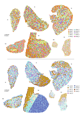 Ontogeny-independent expression of LPCAT2 in granuloma macrophages during experimental visceral leishmaniasis