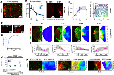 Brain PDGFRβ+ cells exhibit diverse reactive phenotypes after stroke without requiring KLF4