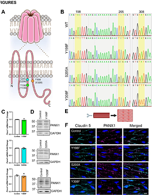 Pannexin 1 phosphorylation sites differentially modulate channel activity and physiological outcomes