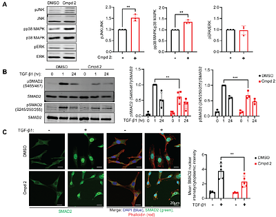 MAPK Phosphatase-5 is required for TGF-β signaling through a JNK-dependent pathway