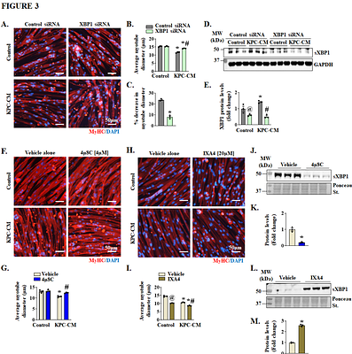 Targeting the canonical ER stress IRE1α/XBP1 pathway counteracts pancreatic cancer-induced skeletal muscle wasting