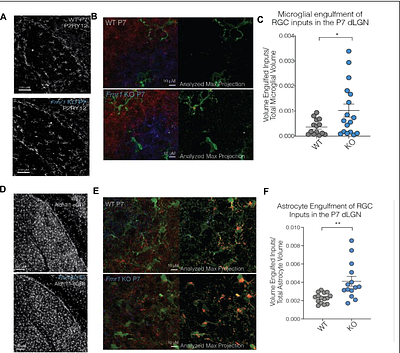 Disrupted glial-mediated synaptic refinement in Fragile X syndrome