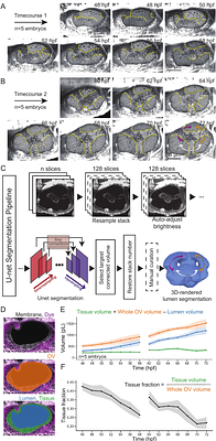 Hydrostatic pressure shapes and canalizes semicircular canal morphology to ensure vestibular function
